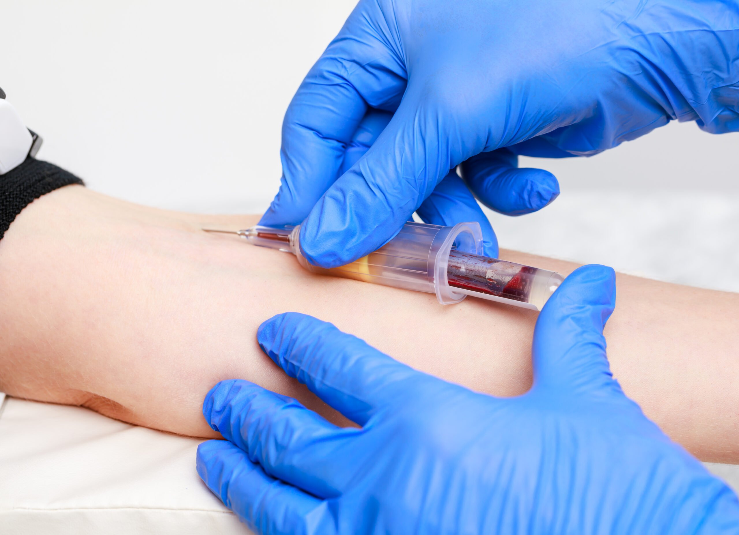 An Understanding of Venepuncture (Adult or Child as applicable)