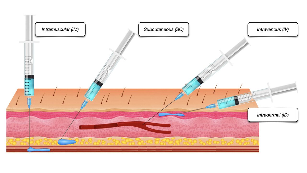 An Understanding of Injectable LHRH agonists