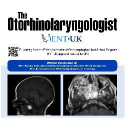 The Otorhinolaryngologist