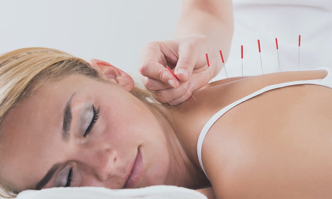 Diploma in Acupuncture