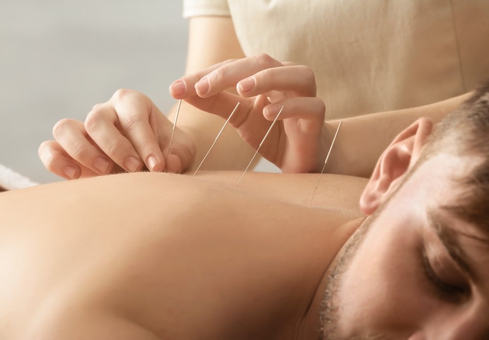 Medical Acupuncture Course: Advancing Your Expertise in Acupuncture Therapy