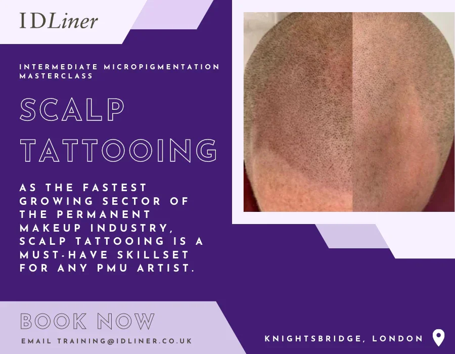 Scalp Micropigmentation | Intermediate - Micropigmentation Masterclass