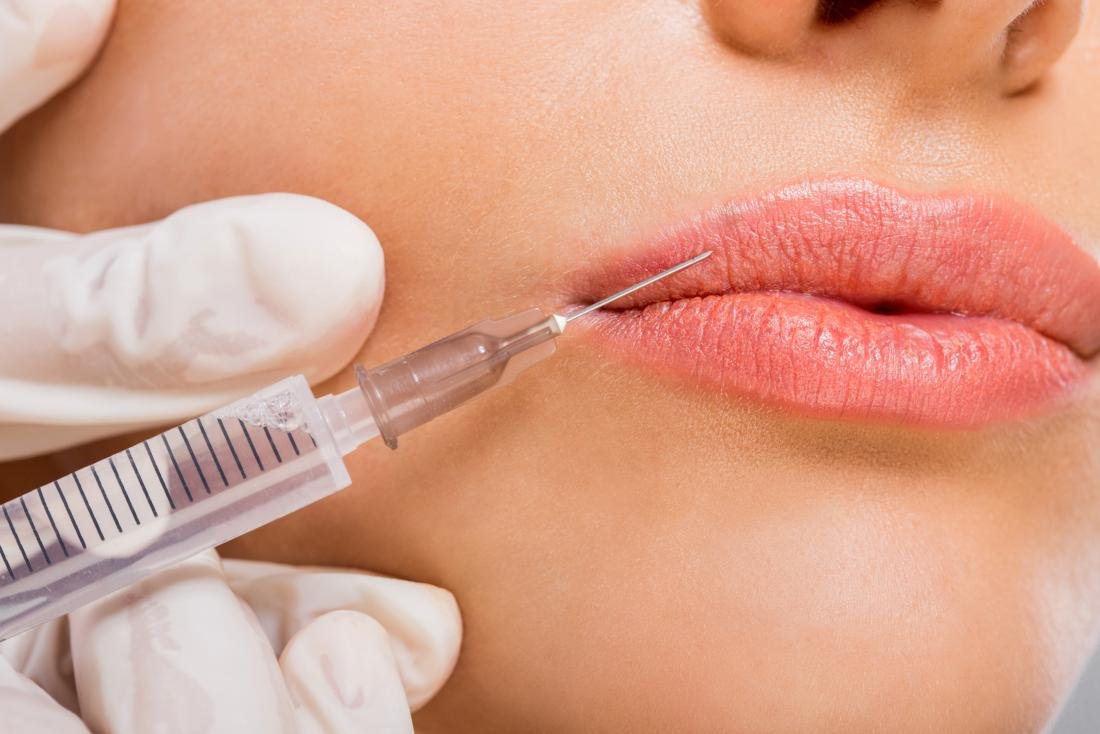 Pathway to Injectables (Filler/Botox)