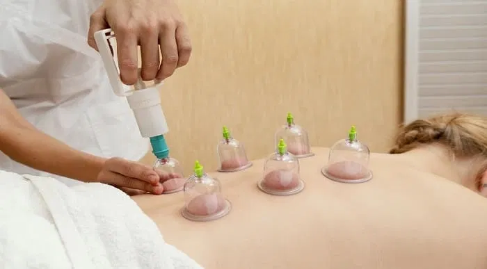 Cupping Therapy Diploma