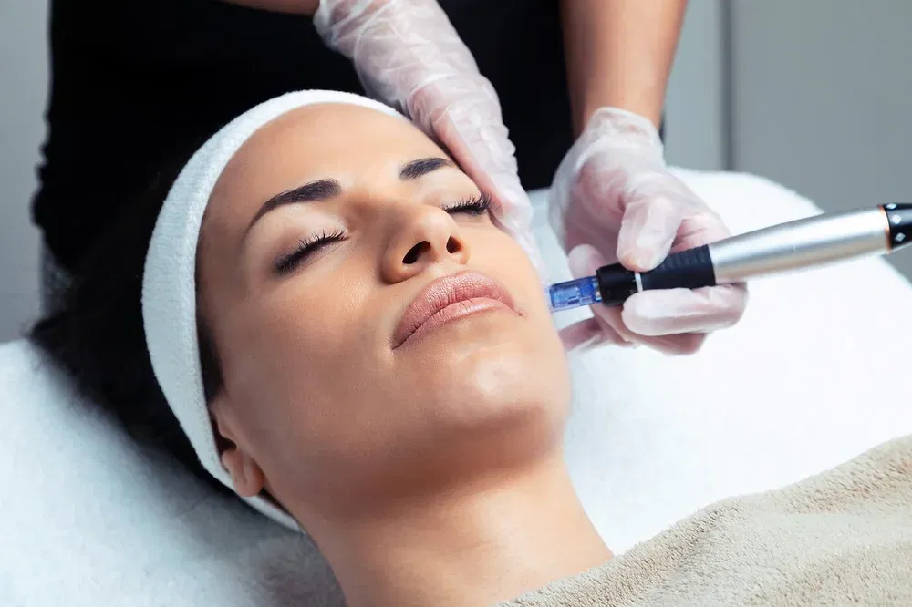 Microneedling Course in person