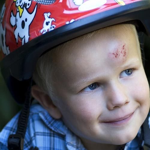 First Aid for Childhood Accidents