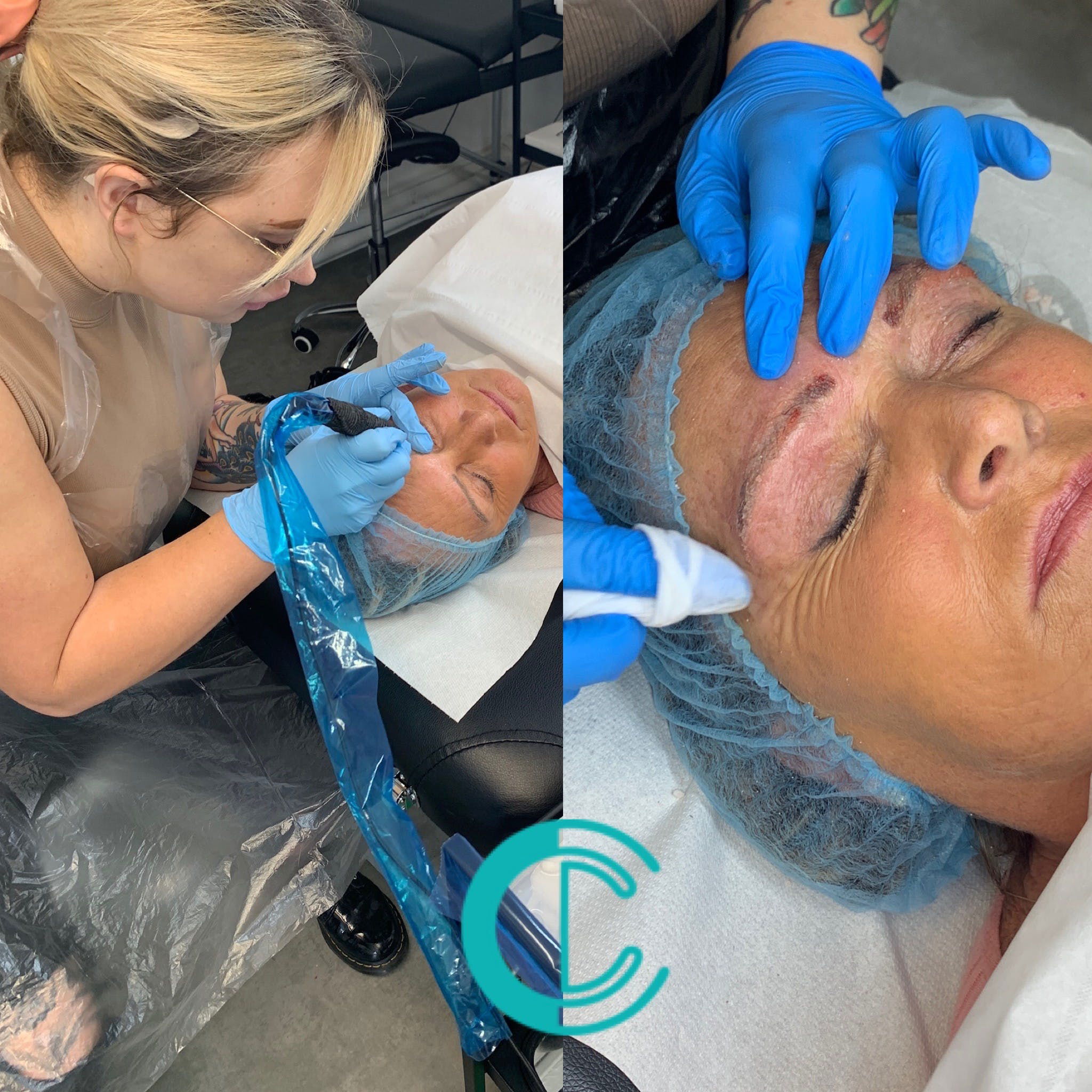 Permanent Makeup Removal & Correction