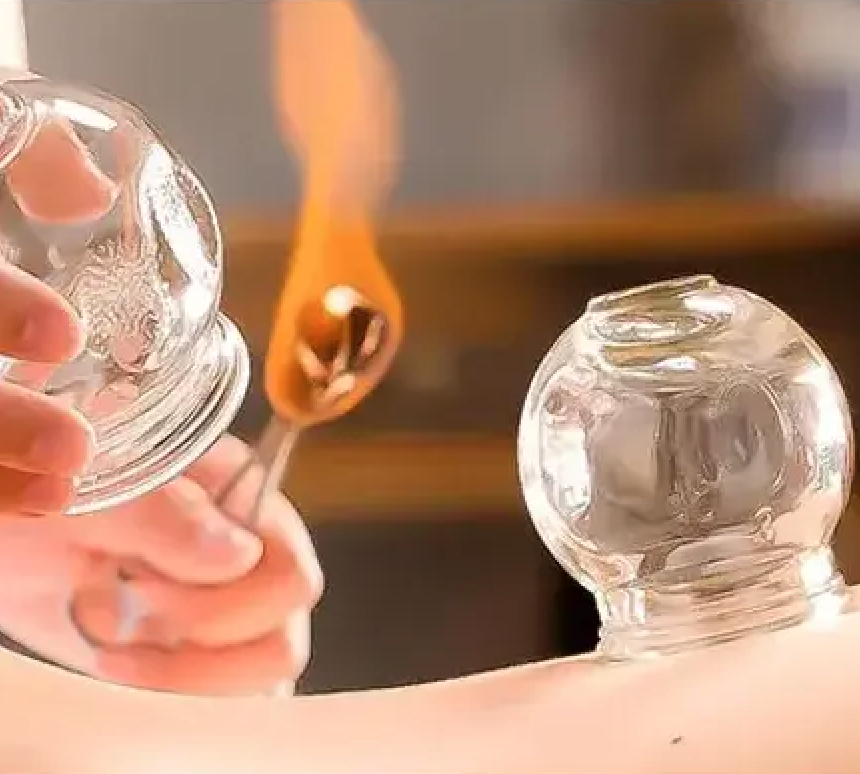 Fire Cupping CPD Course