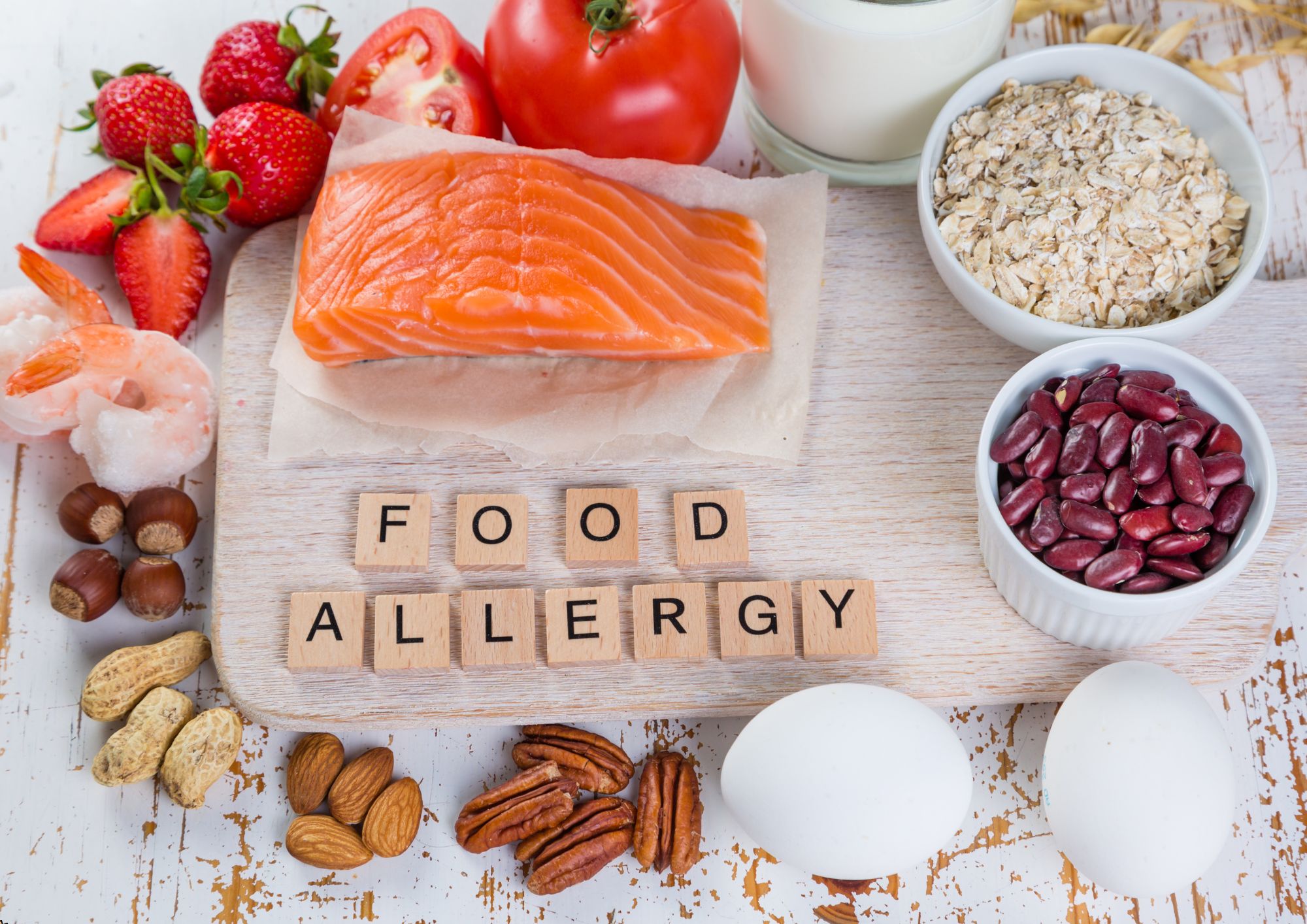 Food Allergen